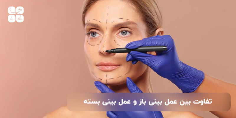 تفاوت بین عمل بینی باز  و عمل بینی بسته