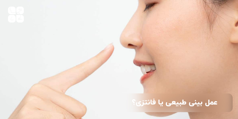 عمل بینی طبیعی یا فانتزی ؟